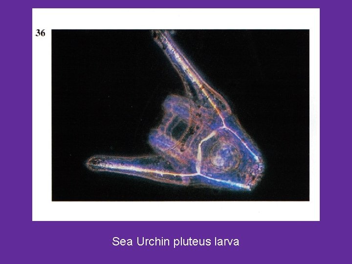 Sea Urchin pluteus larva 