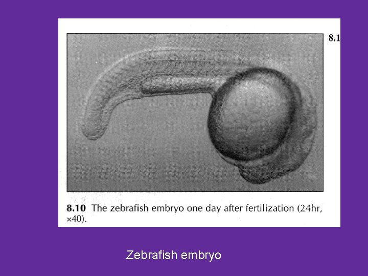 Zebrafish embryo 
