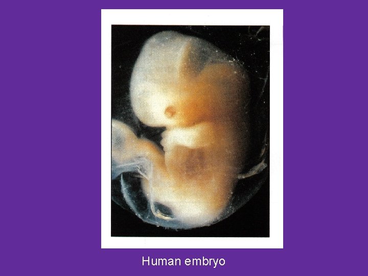 Human embryo 