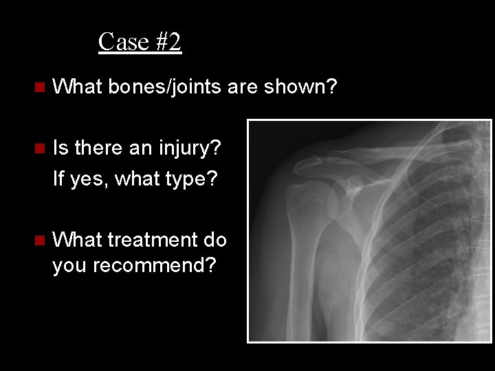 Case #2 n What bones/joints are shown? n Is there an injury? If yes,