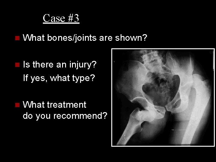 Case #3 n What bones/joints are shown? n Is there an injury? If yes,