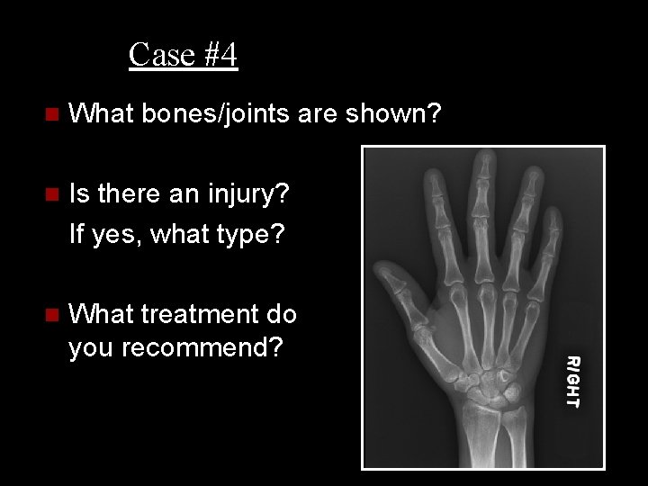 Case #4 n What bones/joints are shown? n Is there an injury? If yes,