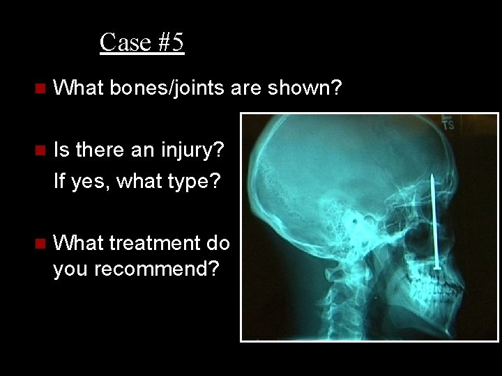 Case #5 n What bones/joints are shown? n Is there an injury? If yes,