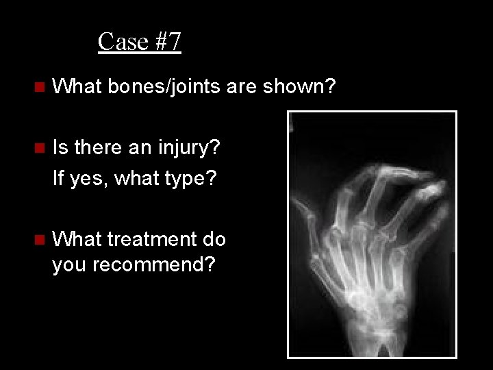 Case #7 n What bones/joints are shown? n Is there an injury? If yes,