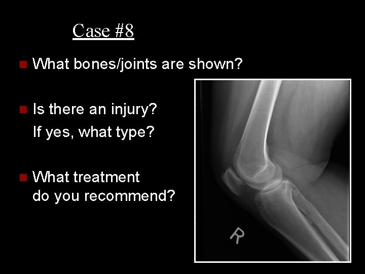 Case #8 n What bones/joints are shown? n Is there an injury? If yes,