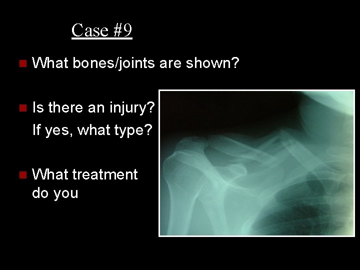 Case #9 n What bones/joints are shown? n Is there an injury? If yes,