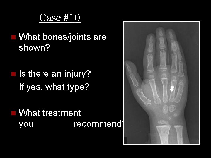 Case #10 n What bones/joints are shown? n Is there an injury? If yes,