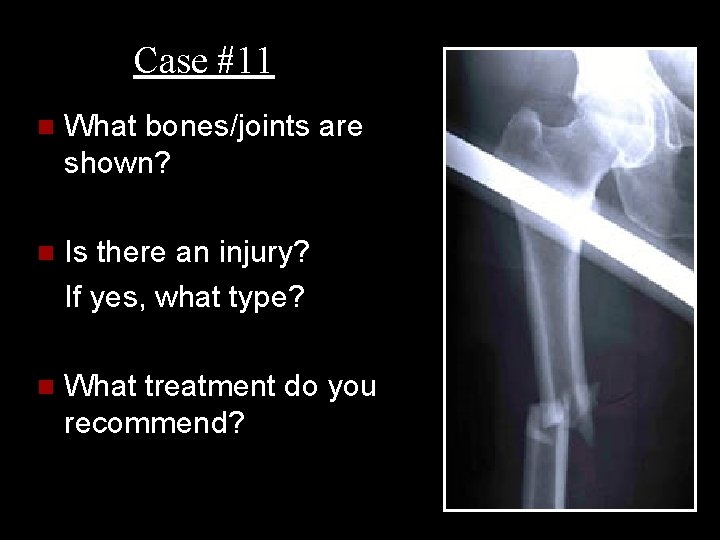 Case #11 n What bones/joints are shown? n Is there an injury? If yes,