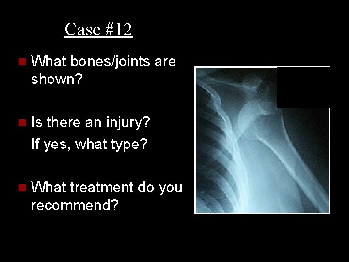 Case #12 n What bones/joints are shown? n Is there an injury? If yes,