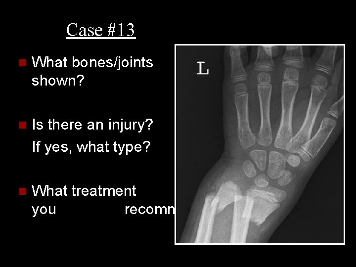 Case #13 n What bones/joints shown? are n Is there an injury? If yes,