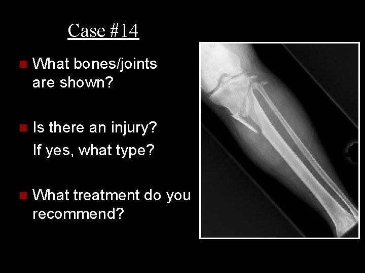 Case #14 n What bones/joints are shown? n Is there an injury? If yes,