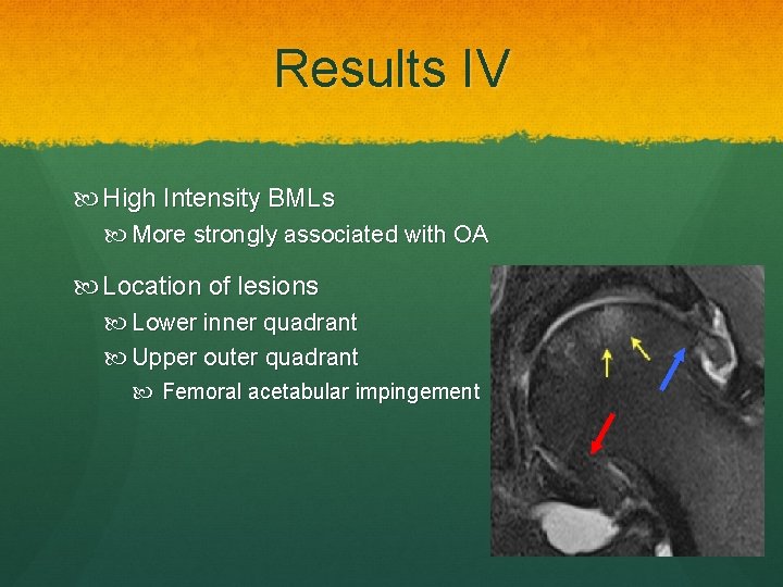 Results IV High Intensity BMLs More strongly associated with OA Location of lesions Lower