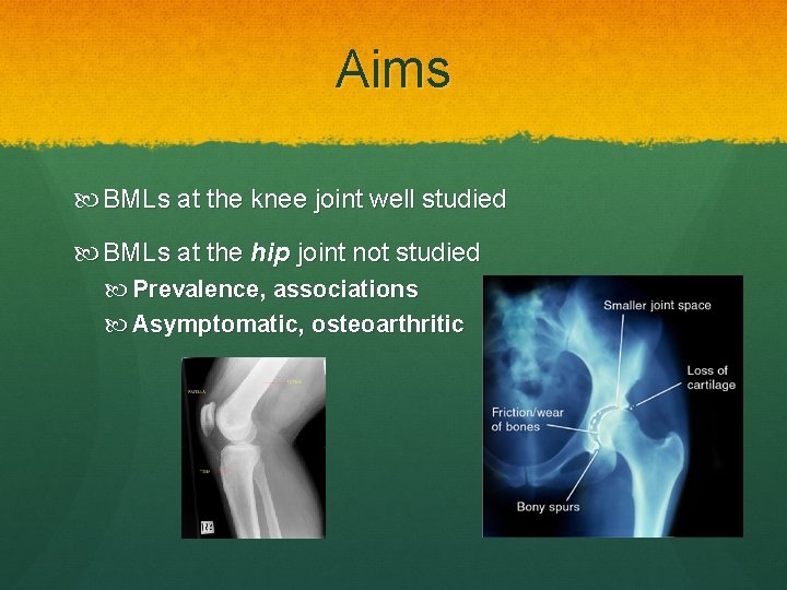 Aims BMLs at the knee joint well studied BMLs at the hip joint not