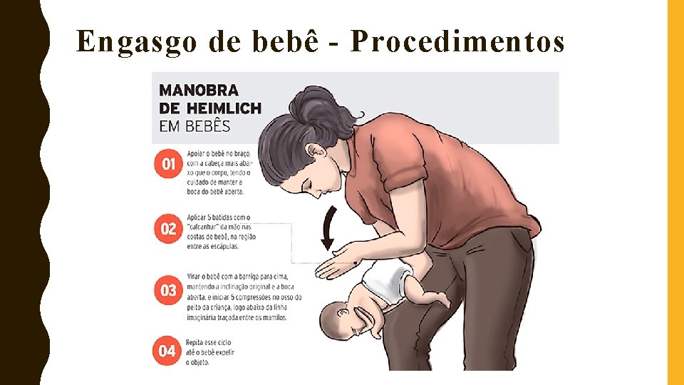 Engasgo de bebê - Procedimentos 