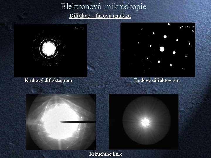Elektronová mikroskopie Difrakce – fázová analýza Kruhový difraktogram Bodový difraktogram Kikuchiho linie 