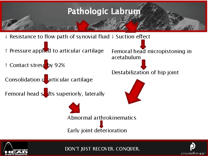 Pathologic Labrum ↓ Resistance to flow path of synovial fluid ↓ Suction effect ↑