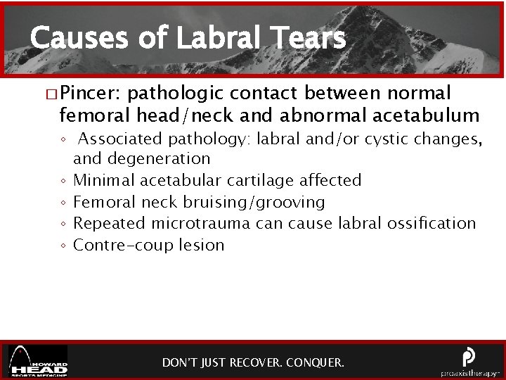 Causes of Labral Tears � Pincer: pathologic contact between normal femoral head/neck and abnormal