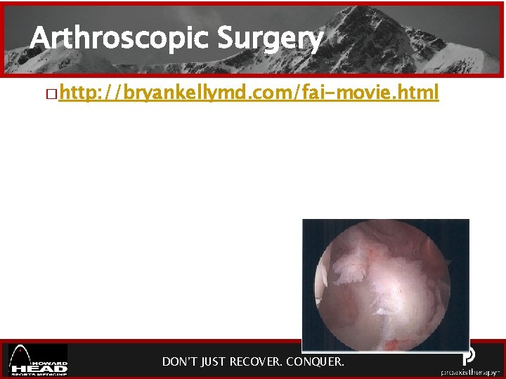 Arthroscopic Surgery � http: //bryankellymd. com/fai-movie. html DON’T JUST RECOVER. CONQUER. 