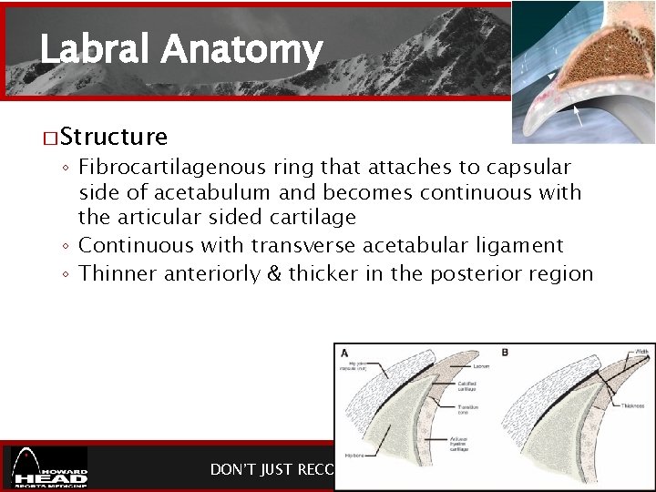 Labral Anatomy � Structure ◦ Fibrocartilagenous ring that attaches to capsular side of acetabulum