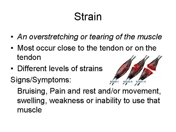 Strain • An overstretching or tearing of the muscle • Most occur close to