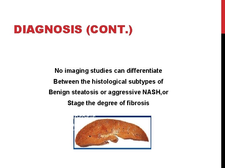DIAGNOSIS (CONT. ) No imaging studies can differentiate Between the histological subtypes of Benign