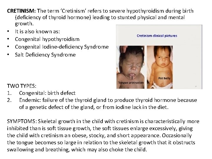 CRETINISM: The term ‘Cretinism’ refers to severe hypothyroidism during birth (deficiency of thyroid hormone)