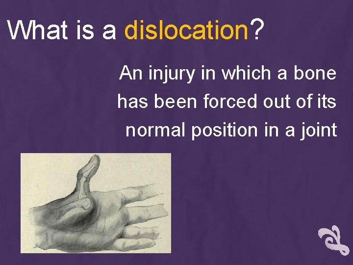 What is a dislocation? An injury in which a bone has been forced out