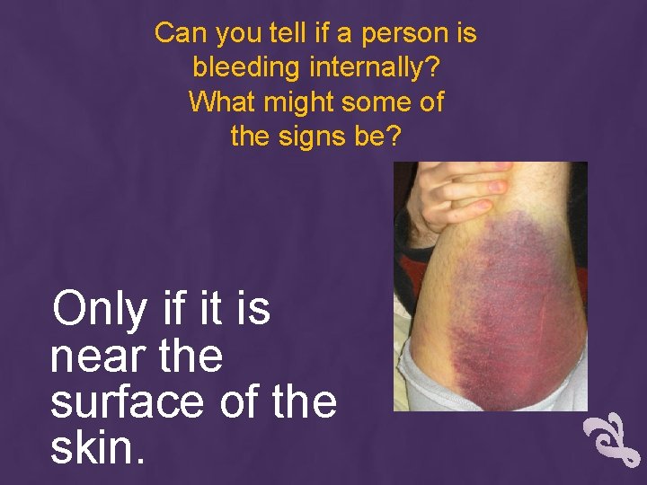 Can you tell if a person is bleeding internally? What might some of the