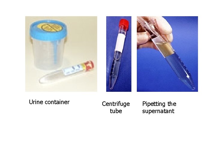 Urine container Centrifuge tube Pipetting the supernatant 