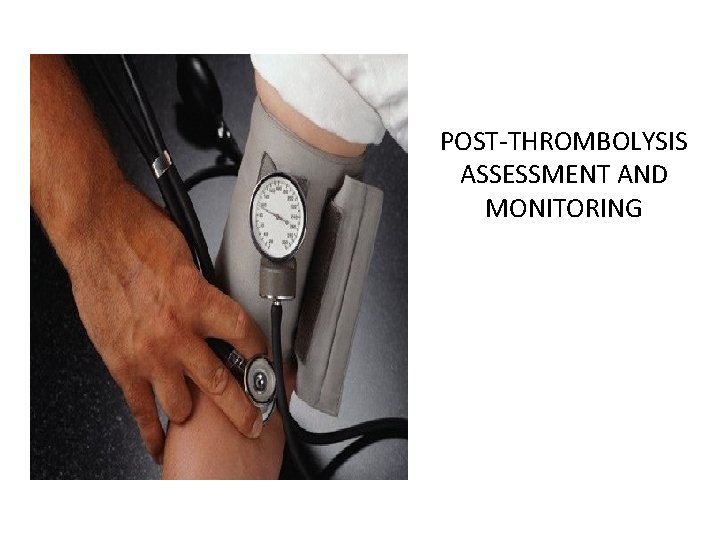 POST-THROMBOLYSIS ASSESSMENT AND MONITORING 
