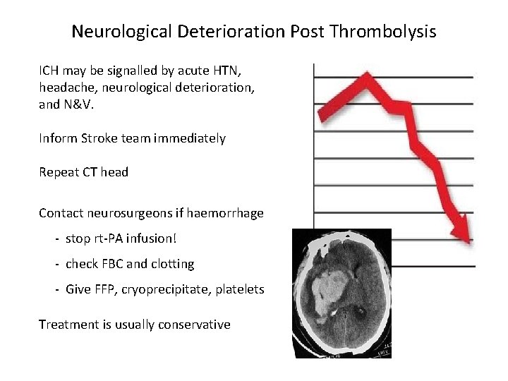 Neurological Deterioration Post Thrombolysis ICH may be signalled by acute HTN, headache, neurological deterioration,