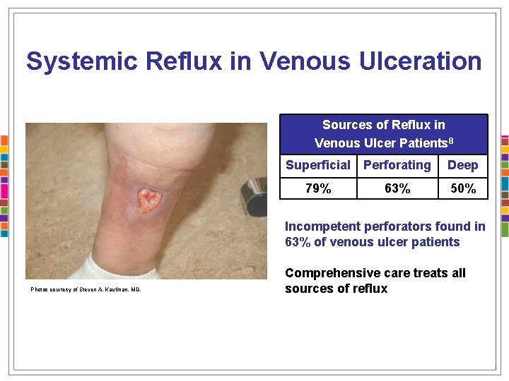 Systemic Reflux in Venous Ulceration Sources of Reflux in Venous Ulcer Patients 8 Superficial