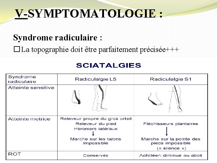 V-SYMPTOMATOLOGIE : Syndrome radiculaire : �La topographie doit être parfaitement précisée+++ 