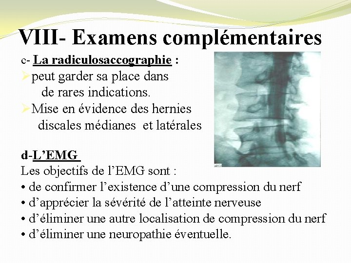 VIII- Examens complémentaires c- La radiculosaccographie : Øpeut garder sa place dans de rares