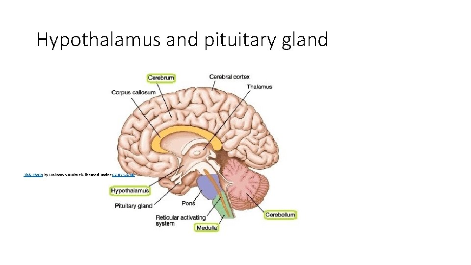 Hypothalamus and pituitary gland This Photo by Unknown Author is licensed under CC BY-SA-NC