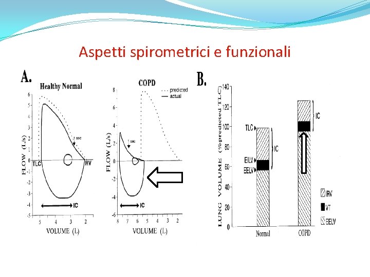 Aspetti spirometrici e funzionali Nice clinical guidelines 101 COPD 2010; Can Resp J 2008;