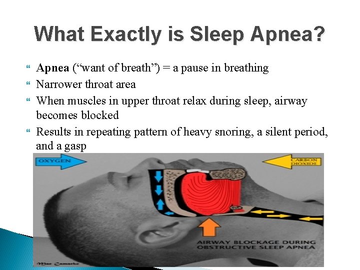 What Exactly is Sleep Apnea? Apnea (“want of breath”) = a pause in breathing