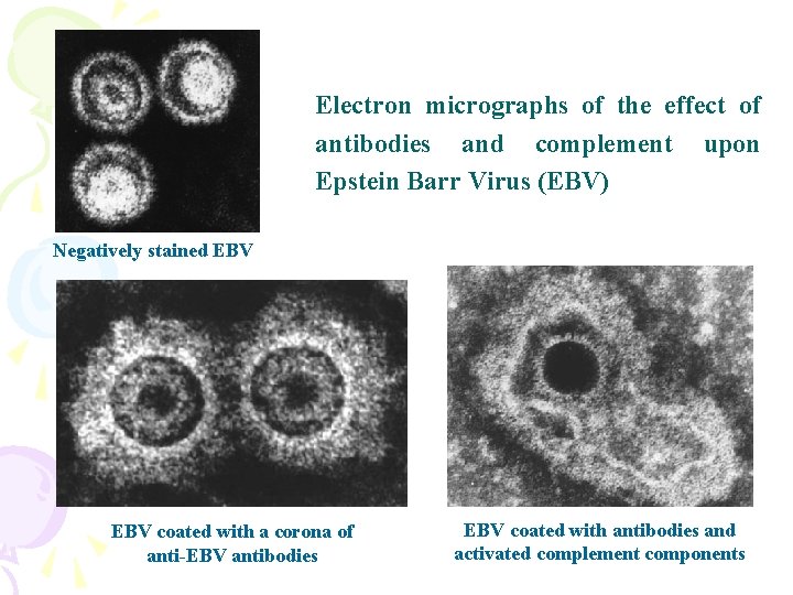 Electron micrographs of the effect of antibodies and complement upon Epstein Barr Virus (EBV)