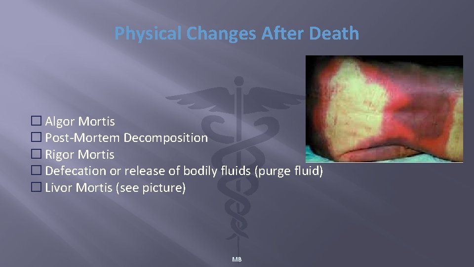 Physical Changes After Death � Algor Mortis � Post-Mortem Decomposition � Rigor Mortis �