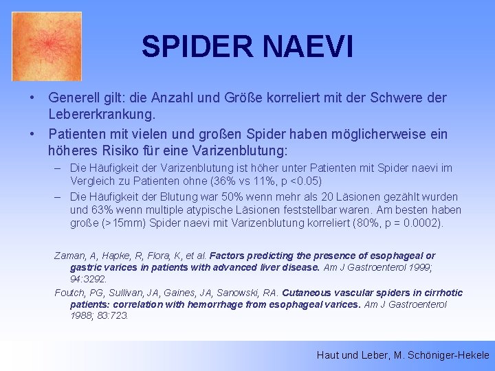 SPIDER NAEVI • Generell gilt: die Anzahl und Größe korreliert mit der Schwere der