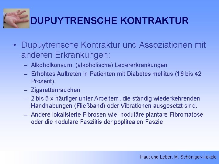 DUPUYTRENSCHE KONTRAKTUR • Dupuytrensche Kontraktur und Assoziationen mit anderen Erkrankungen: – Alkoholkonsum, (alkoholische) Lebererkrankungen