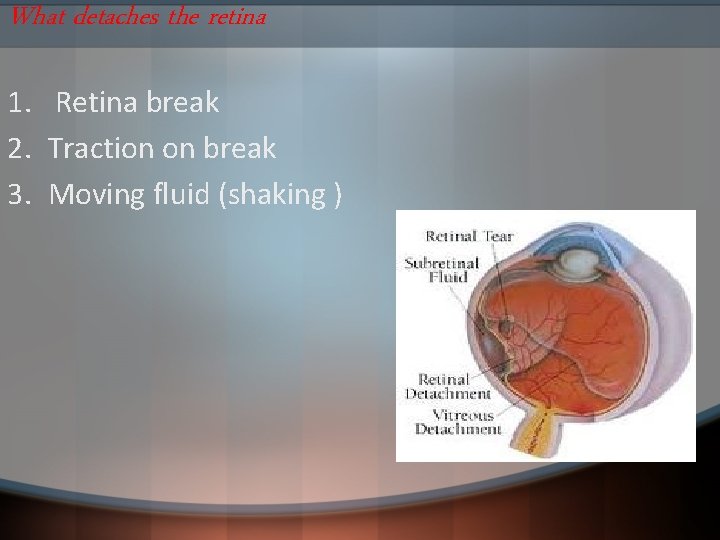 What detaches the retina 1. Retina break 2. Traction on break 3. Moving fluid