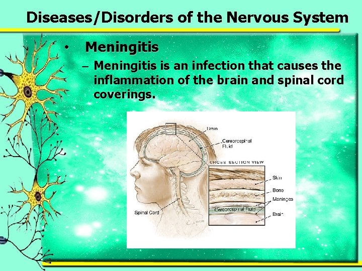 Diseases/Disorders of the Nervous System • Meningitis – Meningitis is an infection that causes