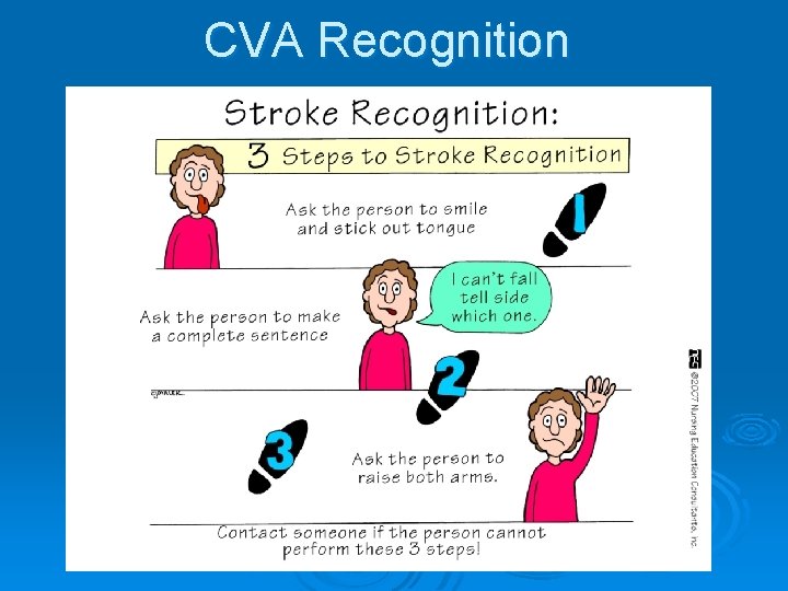 CVA Recognition 
