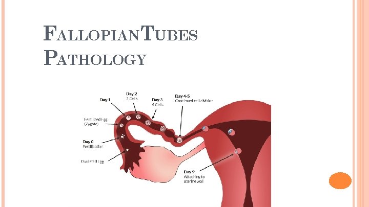 2 FALLOPIAN TUBES PATHOLOGY 