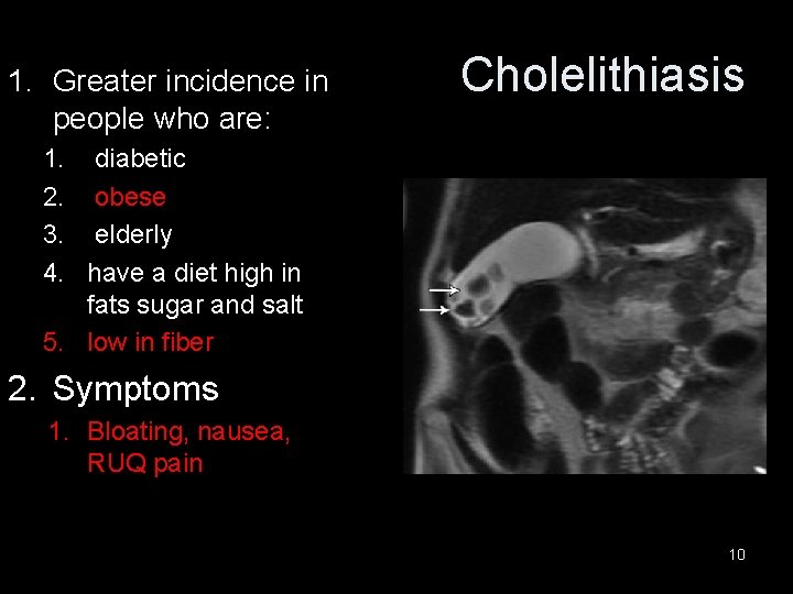 1. Greater incidence in people who are: Cholelithiasis 1. diabetic 2. obese 3. elderly
