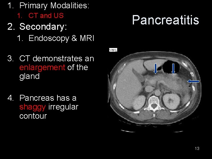 1. Primary Modalities: 1. CT and US 2. Secondary: Pancreatitis 1. Endoscopy & MRI