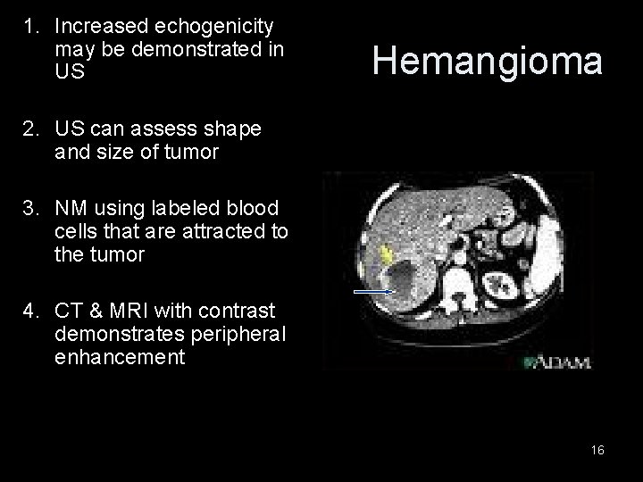 1. Increased echogenicity may be demonstrated in US Hemangioma 2. US can assess shape