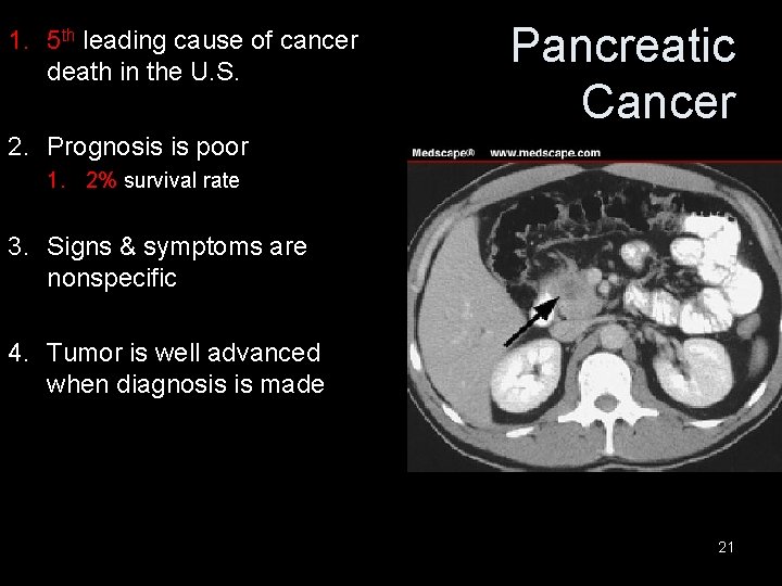1. 5 th leading cause of cancer death in the U. S. Pancreatic Cancer