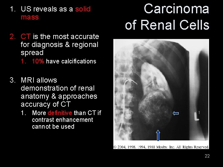 1. US reveals as a solid mass 2. CT is the most accurate for